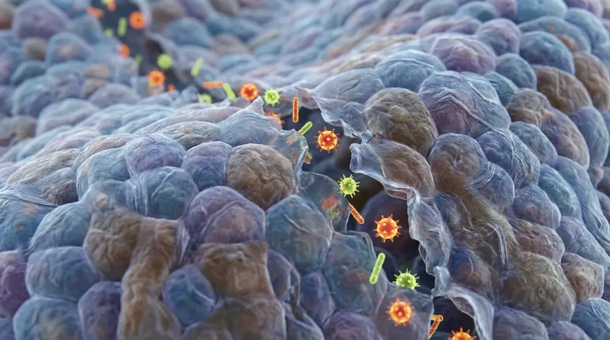 1) 잦은 배탈과 장 트러블